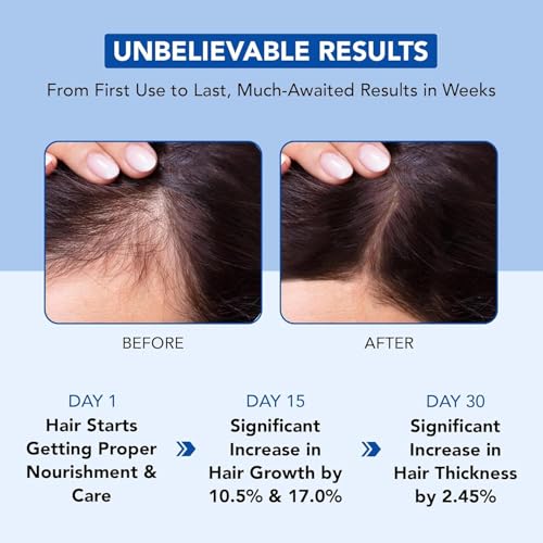 Rosemary Hair Growth Oil with Biotin & Castor Oil