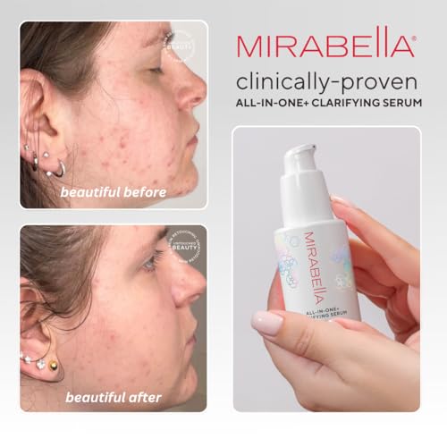 Mirabella All In One Clarifying Serum Micro Peel for Anti Aging - Hydrating 7% Glycolic Acid & 8.8% Lactic Acid Serum Face Peel with AHA BHA Exfoliant, 1 Oz