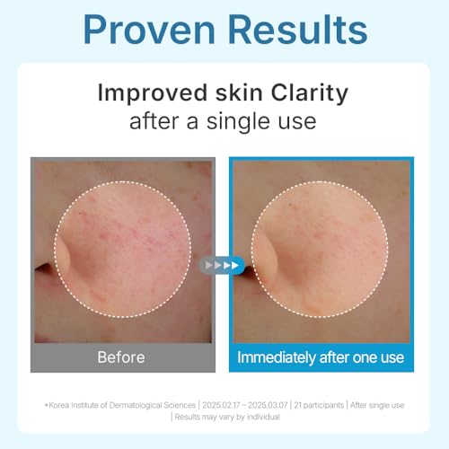 CENTELLIAN 24 Madeca Lab Hyal Waterfull Gel Mask (Hydrating Gel Mask, 5 pcs) ? Deep Moisture & Cooling Sheet with 10-Layer Hyaluronic Acid, Korean Skin Care. TECA, Glycerin, Niacinamide.