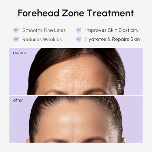 MAREE Forehead Wrinkle Patches – Collagen & Retinol