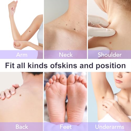 AL-40 Skin Tag & Wart Removal Kit – Professional Home Treatment