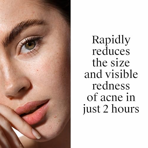 Neutrogena Rapid Clear Acne Spot Treatment Gel 10% Benzoyl Peroxide