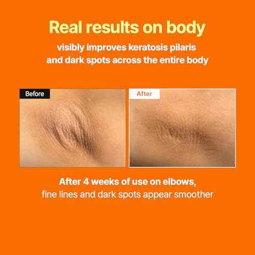 MEDITHERAPY Retinal Skin Booster Serum ? Beginner Friendly Non-Irritating Retinaldehyde for Face and Body ? Anti-Aging Retinol Pore Minimizer for Blemish Prone Skin? Korean Skin Care, 5.07 Fl.Oz Large