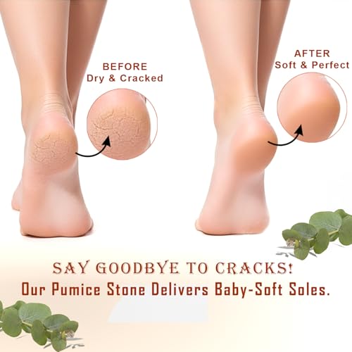 Beauticone Natural Terracotta Pumice Stone - Dual-Sided Foot Callus Remover