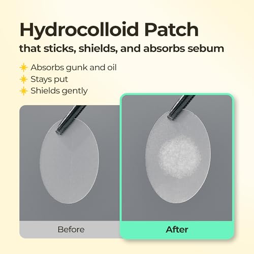 BHA Iconic Spot Patch with Mirror Case - Hydrocolloid Patches with 5,000ppm Salicylic Acid - Day & Night Zit Patch for Targeted Sebum Care & Stylish Wear