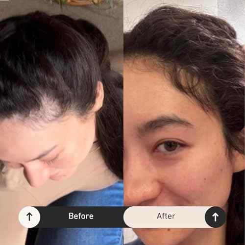 BUR BUR Growing Season Hair Growth And Repair Oil | With Burdock, Nettle Oil and Vitamin C for Visibly Fuller, Stronger and Shinier Hair.