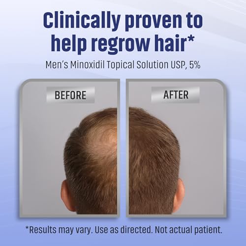 Minoxidil 5% Men's Hair Regrowth Solution 2oz
