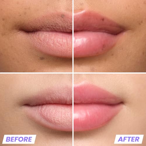 Wonderskin Lip Plumper Gloss - High Shine & Volumizing Lip Gloss