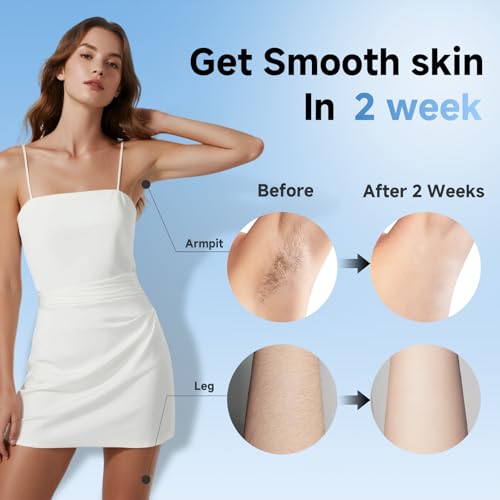 Sapphire Ice IPL Hair Removal Device - Pink, Painless, 5 Levels, Full Body Use