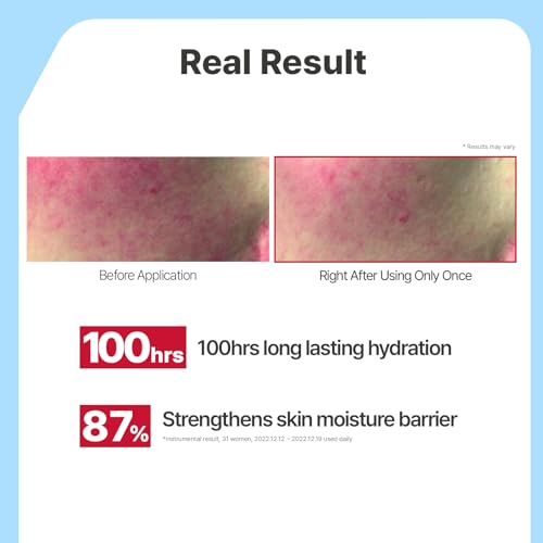 SKIN1004 Probio Cica Enrich Cream 1.69 fl.oz, 50ml, Korean Face Moisturiser, Night Face Cream with Madagascar Centella, Hydrating Moisturizer for Soothing and Strengthening the Skin, Korean Skin Care