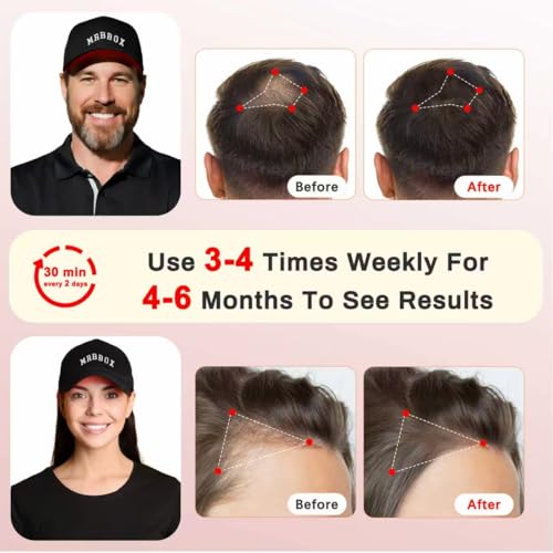 Red Light Hair Growth Cap with 528 Emitters