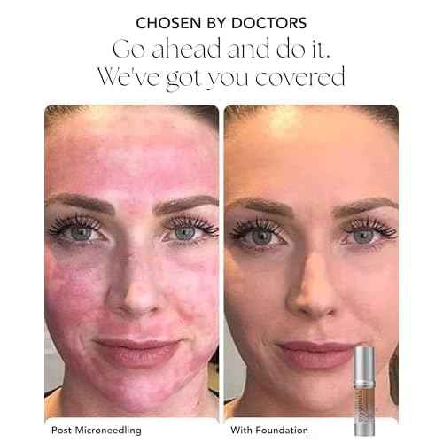 Oxygenetix Oxygenating Foundation | Breathable Makeup for Face | Buildable Coverage with Weightless Feel | Longwear Foundation for Women | Safe for Sensitive or Laser-Treated Skin
