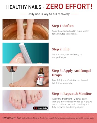 Extra Strength Toenail Fungus Treatment - 25% Undecylenic Acid