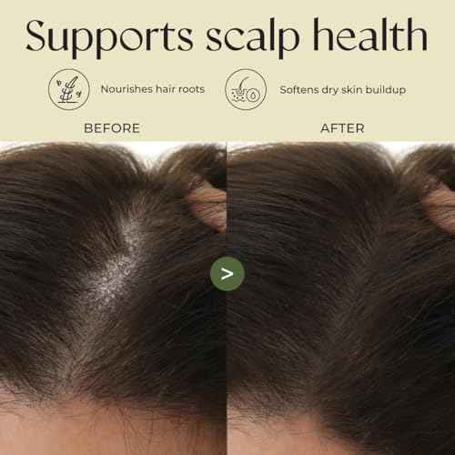 Gya Labs Rosemary & Castor Hair Oil - 4 Fl Oz - for Scalp Health, Strengthens & Protection from Damage