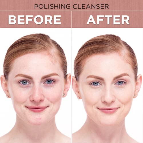Shira Boto-Derm Rx Polishing Cleanser With Anti Anging FormulaMakes Skin Wrinkle Free and Keeps Skin Hydrated and NourishedUseful for Normal to Dry Skin (150ml)