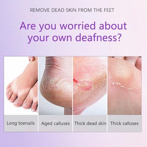 Electric Callus Remover with Dual Grinding Heads - USB Powered