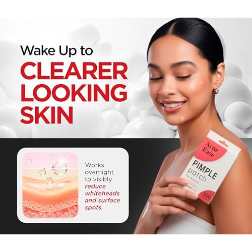 Clear Pimple Patches with Ultra-Thin Hydrocolloid ? 300 Cosmetic Zit Patches in 3 Sizes ? Face Pimple Stickers for Daily Use