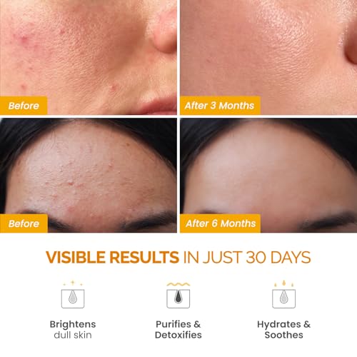 PLANTIFIQUE Korean Turmeric Clay Mask 110g – Vitamin C & Volcanic Mud