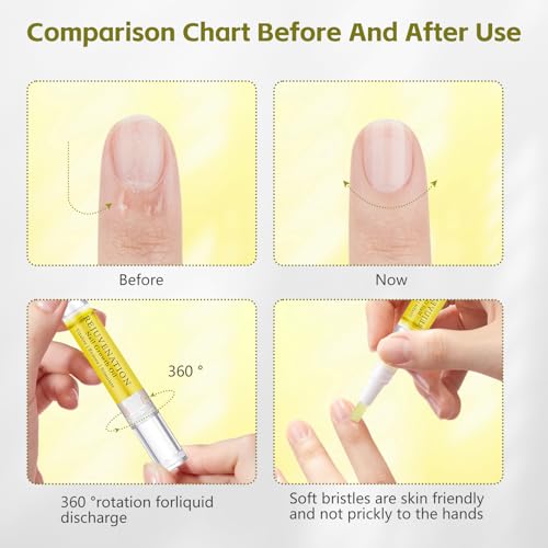 Rejuvenation Nail Growth Oil & Cuticle Care Pens with File (4 Pack)