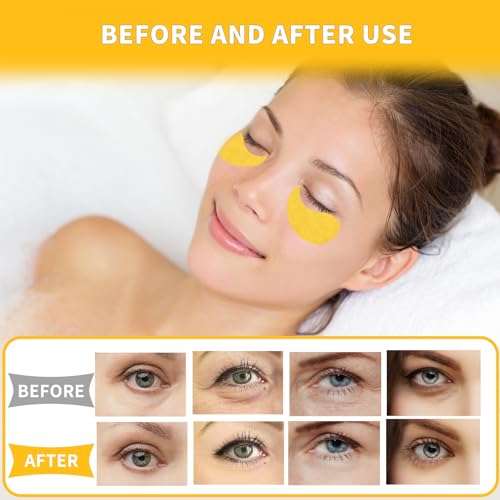 Qyiywim 7.1oz Gold Under Eye Patches for Dark Circles & Puffiness - Luxurious 24K Eye Masks for Men & Women