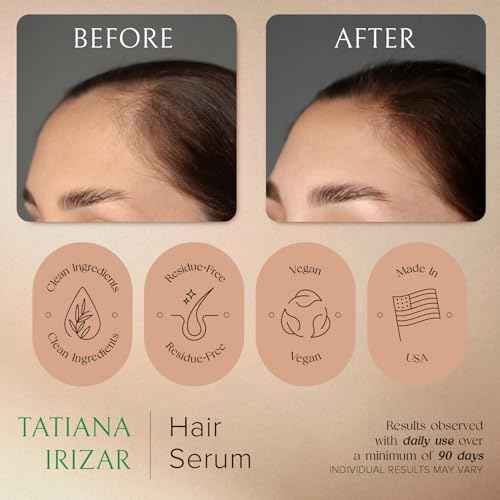 Hair Serum for Hair Growth Serum Women Made in USA - 3 Pack Scalp Serum for Hair Growth Non-Greasy Rosemary & Amla Hair Care Vegan 1 Oz Hair Loss Treatment for Women Regrowth Treatment
