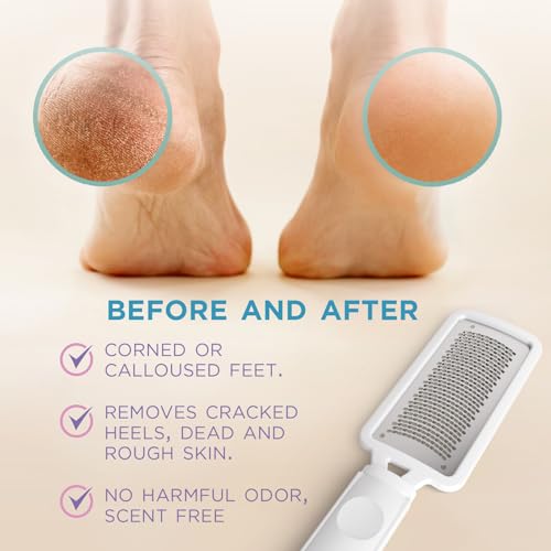 Professional Callus Remover Foot File for Smooth, Soft Feet