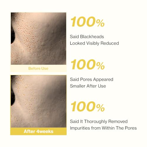 YUMU Coix Seed Deep Pore Cleansing Oil, Vitamin E, BHA, Double Cleansing, Waterproof Makeup Remover, Gentle Oil Cleanser, Blackhead Remover, No Oily Residue, Korean Skin Care (200ml/6.76 fl.oz.)