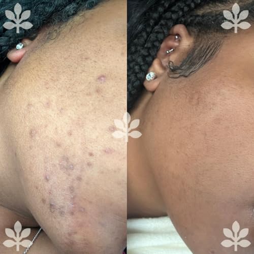 The Goat Face & Body Bar - Fades hyperpigmentation, Nourishes, Brightens for All Skin Types