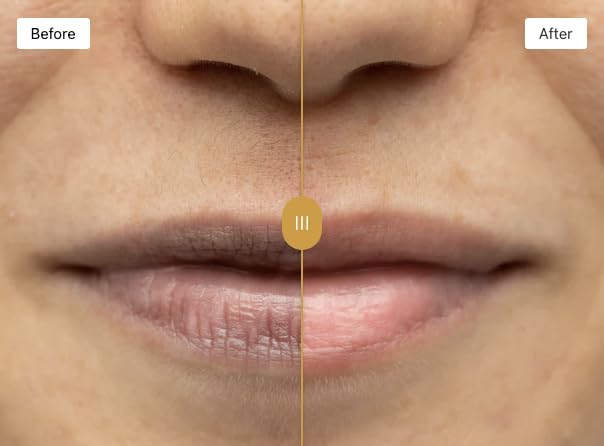 Lip Lightening Scrub - Vitamin E & Natural Exfoliating Treatment