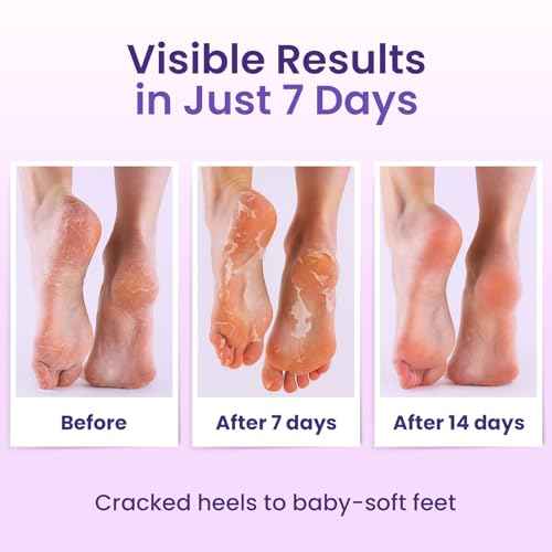 Foot Peeling Mask (2 pairs) Exfoliating Foot Mask for Dry Cracked Feet with Lavender & Shea Butter, Dead Skin & Callus Remover for Feet, Exfoliating Socks for Women & Men, One Size Fits Most