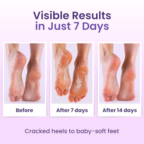 BLOOMORA Exfoliating Foot Peeling Mask with Lavender & Shea Butter - 6 Pairs