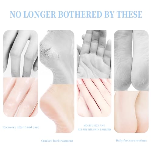 BTYJLEBE Foot Moisturizer Stick for Cracked Heels & Dry Skin - 40g
