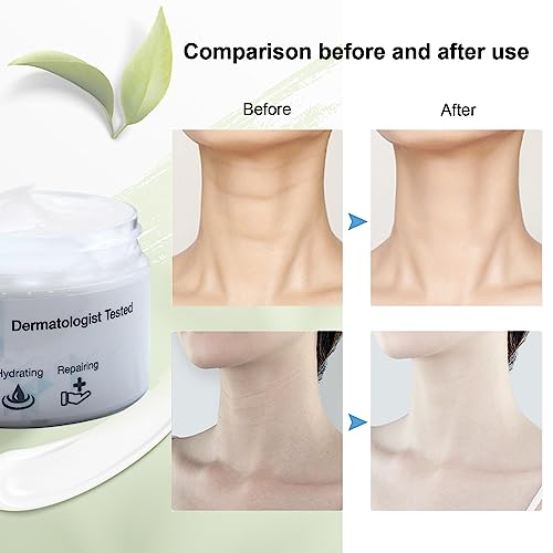 Neck Firming Cream - Face Lift Moisturizer and Anti-Aging Collagen Cream with Retinol, Peptides & Vitamin E for Smooth Wrinkle, Fine Lines, Hydrating and Restore Skin Elasticity