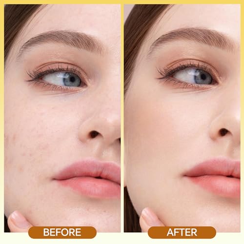 10% Vitamin C Serum for Face - with Hyaluronic Acid, Brightening Facial Serum, Skin Care for Glowing Complexion