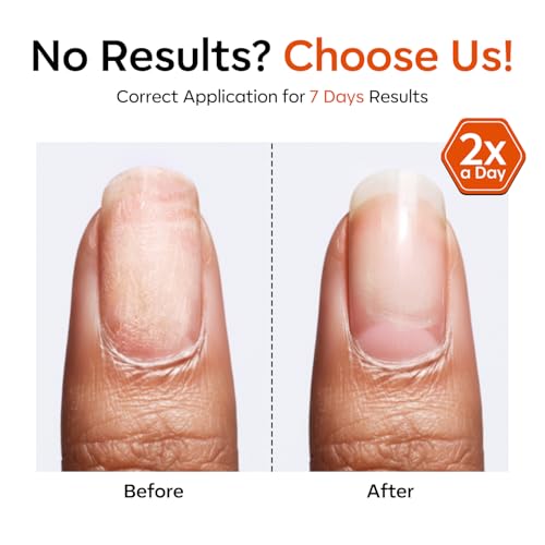 Modelones Nail Strengthener & Growth Serum 13.5ml