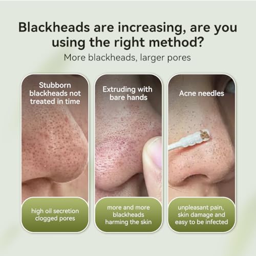 LANBENA Blackhead Remover Mask Nose strips Charcoal Mask Peel off Mask Facial Pore Cleanser Purifying Face Mask 1.06 Ounce