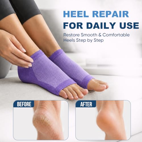 Moisturizing Heel Socks - 2 Pairs Toeless Gel Socks for Cracked Heels