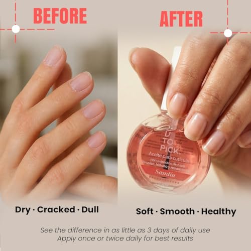 UTOPICK Watermelon Cuticle Oil for Nails - Nourishing 30ml with Olive Extract