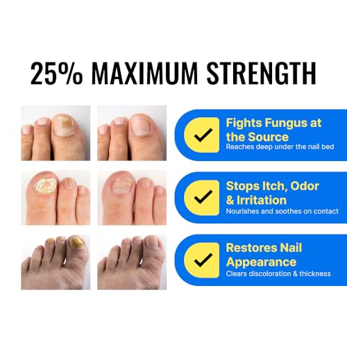 Fungix Extra Strength Nail Serum with Undecylenic Acid & Tea Tree Oil