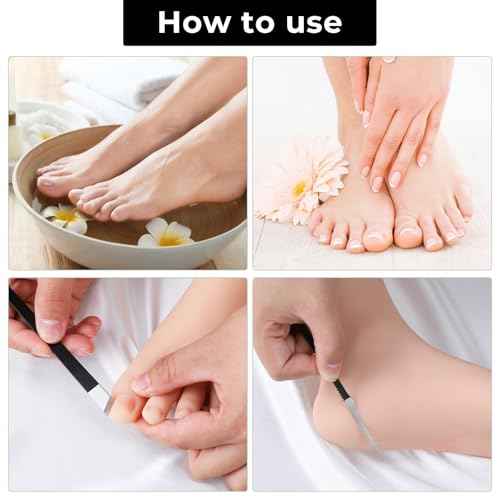 6Pcs Professional Pedicure Knife Kits, Stainless Steel Nail Knives Cuticle Remover Dead Skin Corn Foot Callus Remover Foot Care Tools for Home Beauty Salon