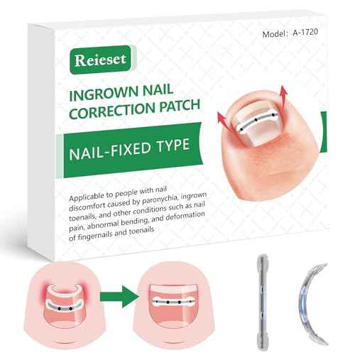 Titanium Alloy Ingrown Toenail Treatment, Nail Tools, and Ingrown Toenail Removal Kit Specially Designed for Curved Nail Repair and Ingrown Toenail Corrector (0.67/0.79in)