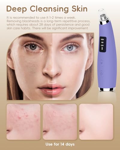 Pore Vacuum Blackhead Remover - 5 Attachments & 3 Suction Levels