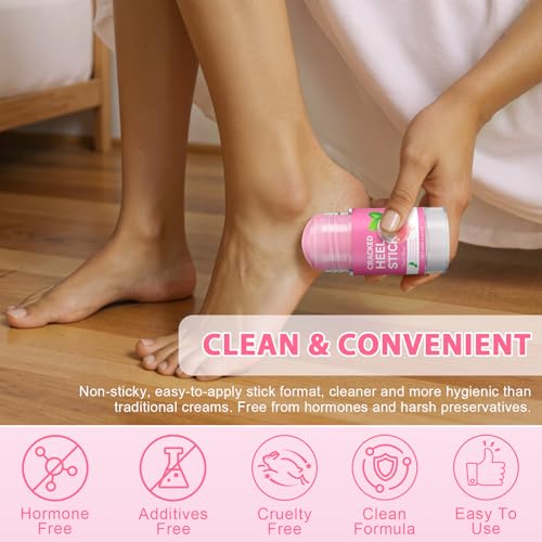 Urea Cream 60% Salicylic Acid Foot Balm Stick for Dry Cracked Heels