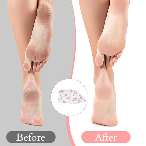 Abeillo Overnight Moisturizing Socks for Dry Cracked Feet - 6 Pairs