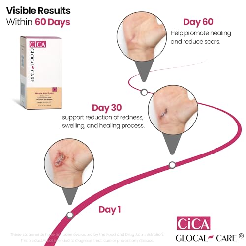CICA Silicone Scar Cream ? New & Old Scar, Stretch Marks & PIH Appearance Improvement - Medical-Grade Silicone with TECA, PASSIOLINE, Hyaluronic Acid & Panthenol - Supports Wound Healing - 50 ml
