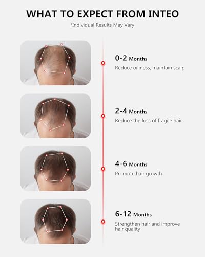 Red Light Therapy for Hair Growth with 162 Lasers