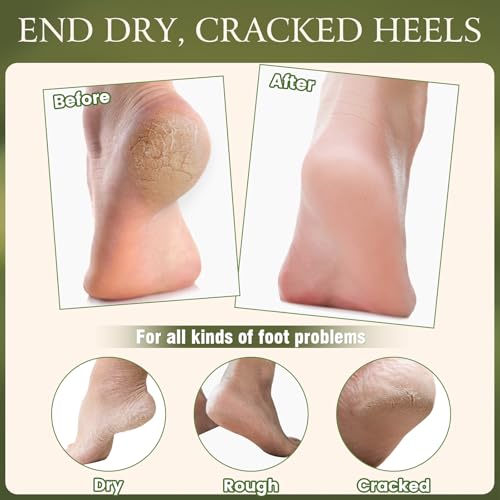 TEAWOO Cracked Heel Repair Set – 2 Balm Sticks & 2 Gel Socks