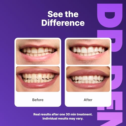 DrDent Purple Teeth Whitening Strips 21 Treatments