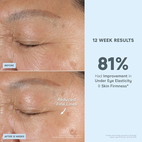 NuFACE Vita-C Brightening Face Serum - Vitamin C Serum for Dark Spots & Even Skin Tone + Niacinamide for Soothing Redness - Boosts Results of Microcurrent Treatments, Daily Skin Care (1oz)
