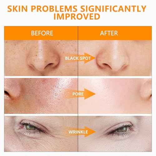 Super Vitamin C Serum for Women over 70 With Hyaluronic Acid, Reduce Wrinkle, Hydrates, Firms, Lifts, Anti Aging Serum for Dark Spots, Wrinkles, DullSkin, 1 fl.oz.